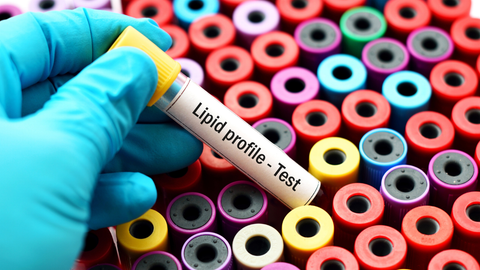 Private Bone Profile Blood Test London | Cost, Markers & Booking – Levitas