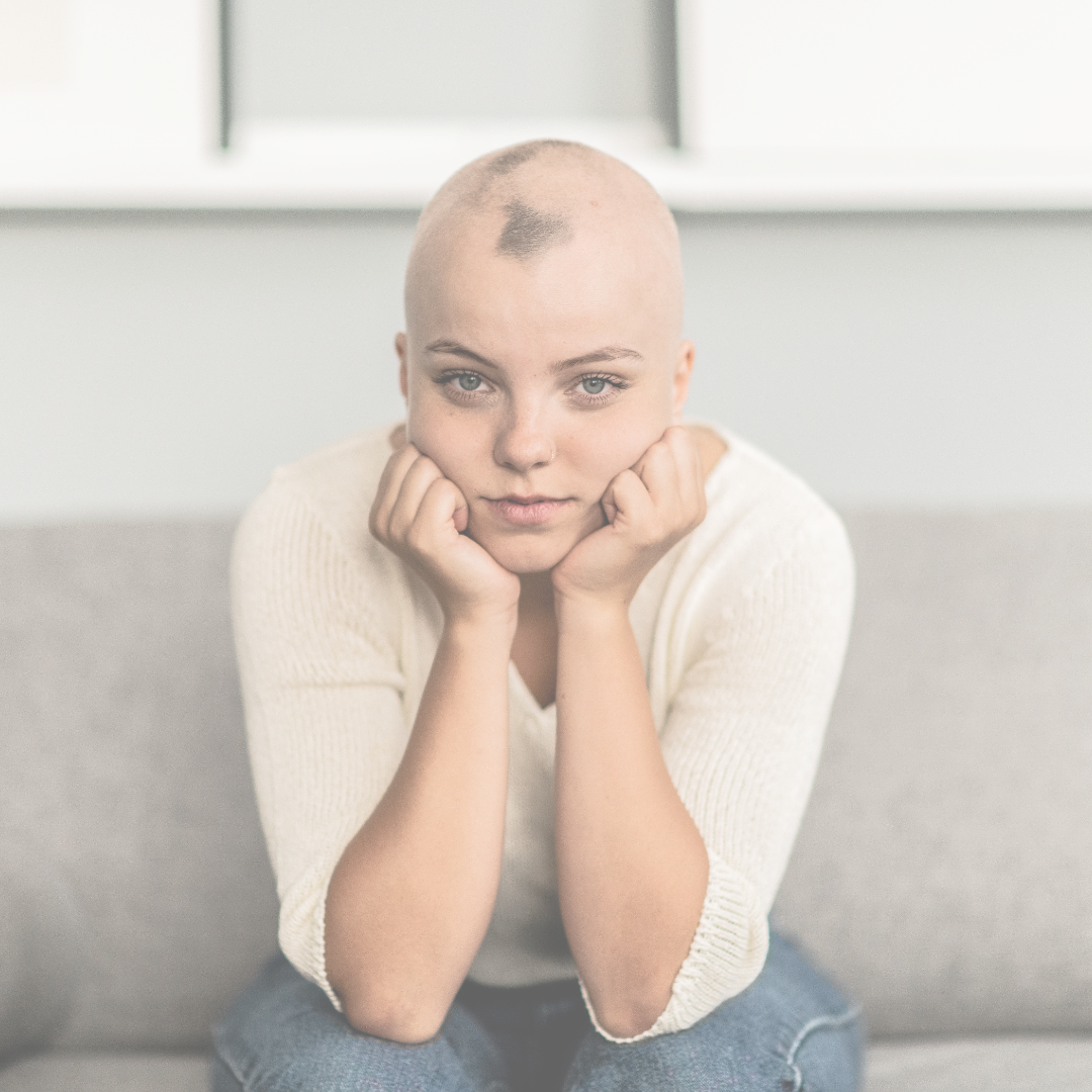 Alopecia